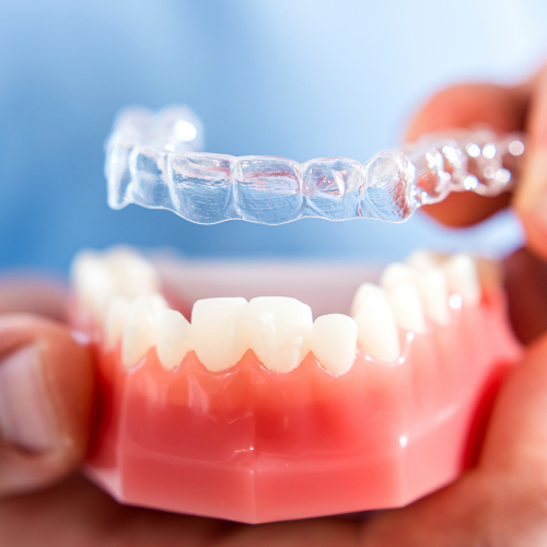 Cosmetic Dentistry Options