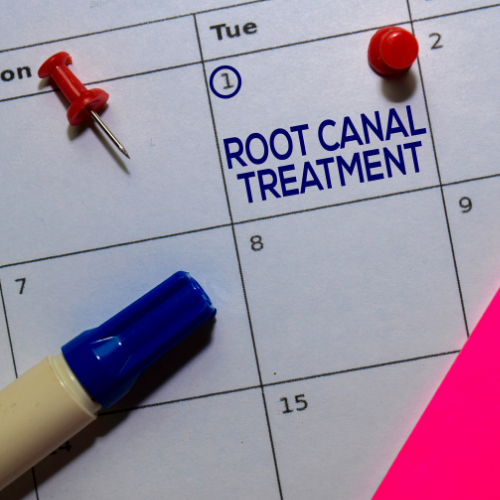 Do I Need A Root Canal?
