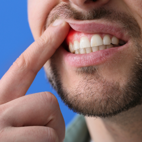 What Does Pain In Your Gums Mean?