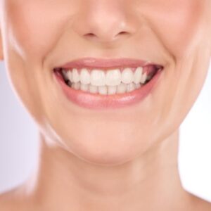 The Difference Between Crowns and Veneers